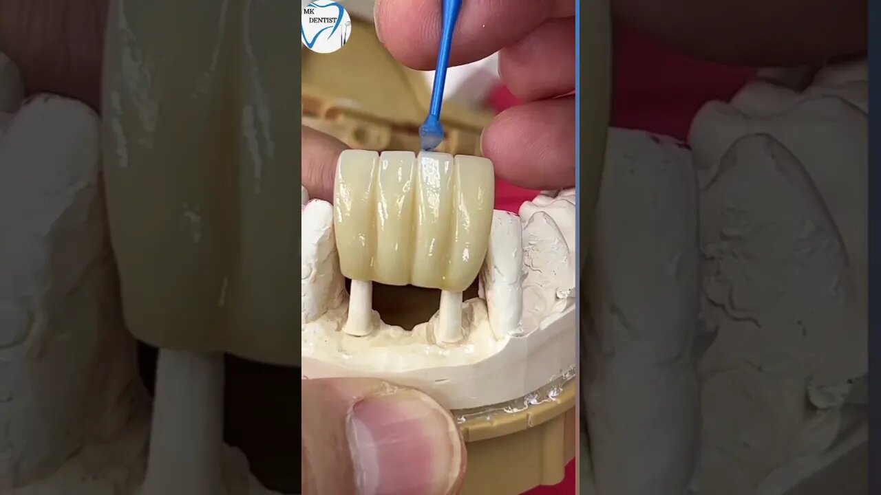 Don't making the neck line for tooth