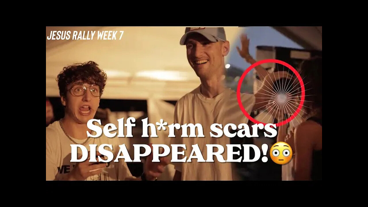 Scars & Scoliosis HEALED BY JESUS | Testimonies JESUS RALLY ep. 7