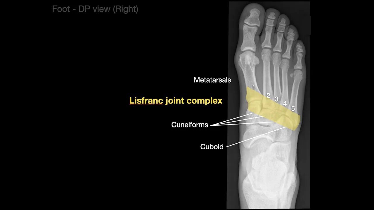 Anatomy of Foot X-rays