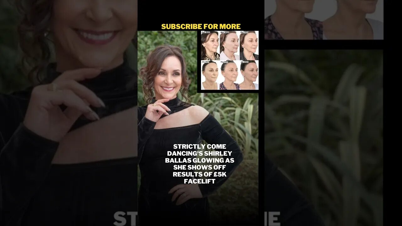 Shirley Ballas Shows Off Results Of £5k Facelift