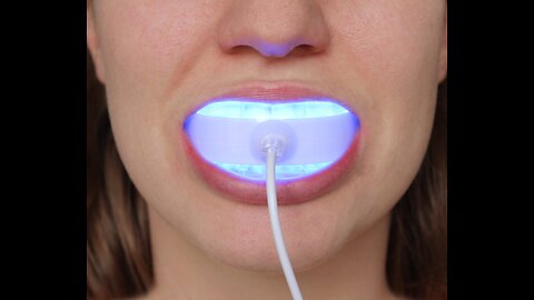 How to whiten your teeth | in the FASTEST way possible