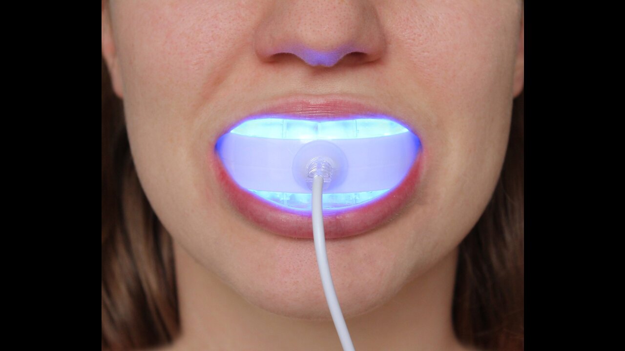 How to whiten your teeth | in the FASTEST way possible