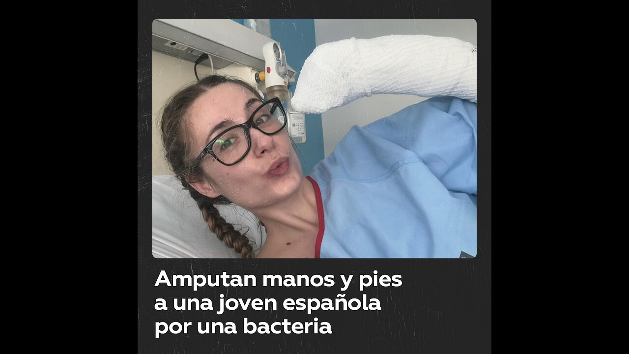 Joven española pierde los pies y las manos a causa de una bacteria