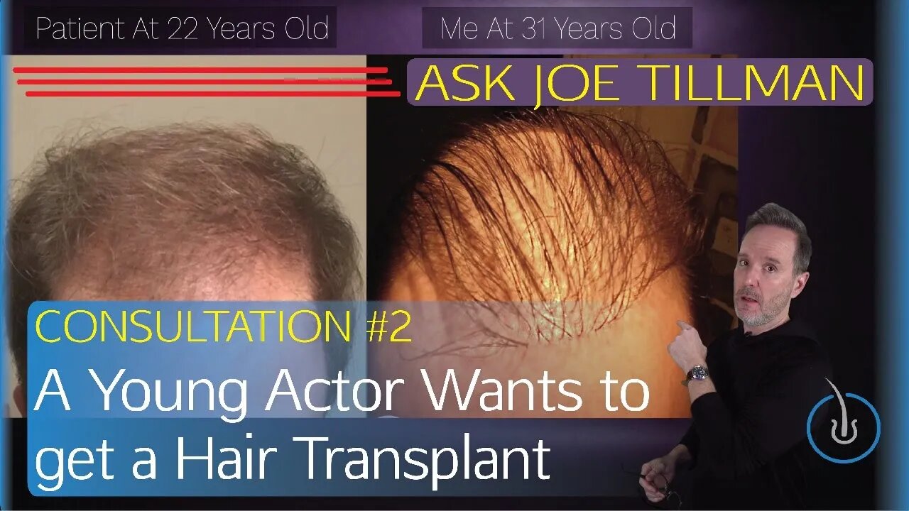 Is This Actor Too Young? Hair Transplant Consultation Ep #2