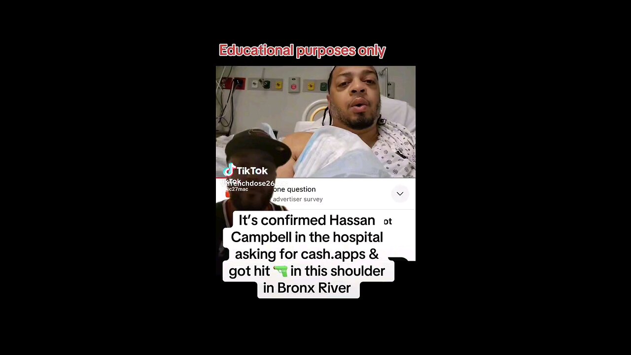 French Dose speaks on What happened with Hassan Campbell 😯😯😯😯😯😯
