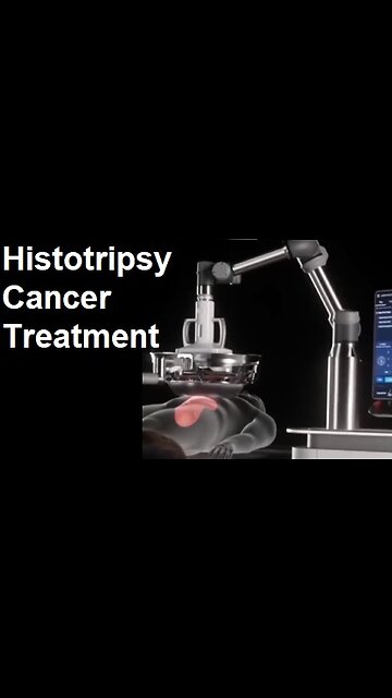 Histotripsy - New Cancer Treatment