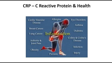 Understanding C Reactive Protein - CRP Levels