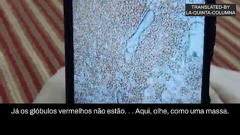 Análise ao microscópio de uma gota de sangue de uma pessoa "vacinada" com Sinopharm.