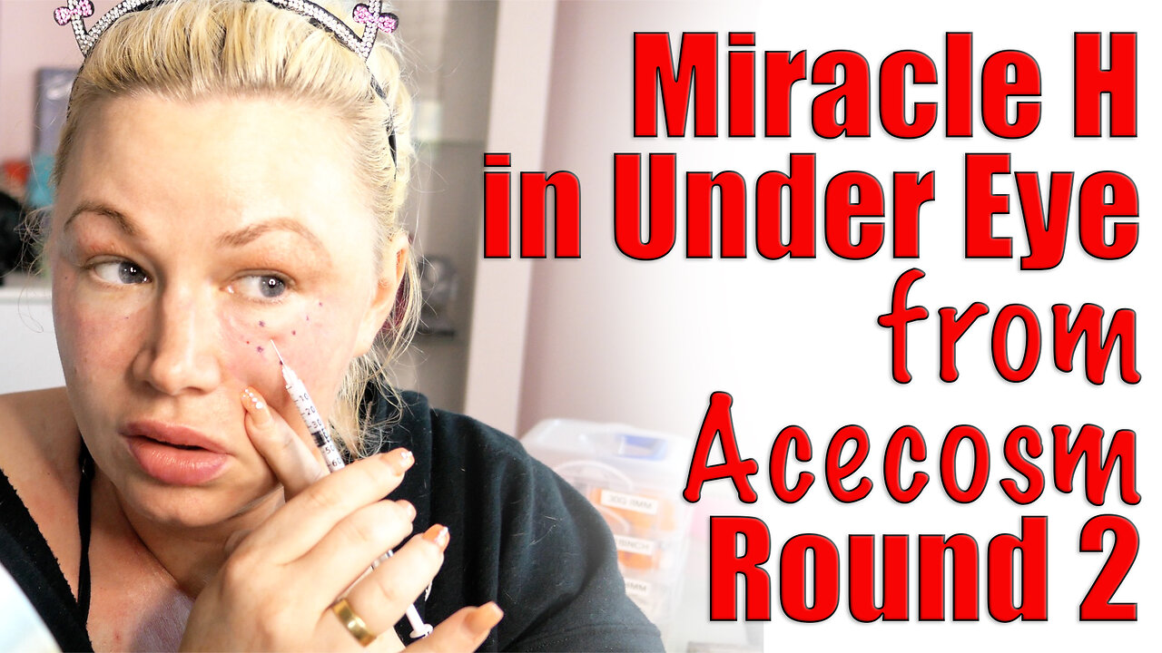 OLD VIDEO RESHARE Miracle H in Under Eyes: Build Collagen! AceCsom, Code Jessica10 Saves you Money