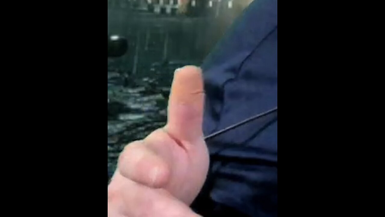 Mr.Metokur laughs at the Mersh almost dying clip I put up.