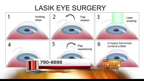 Am I a good candidate for Lasik?