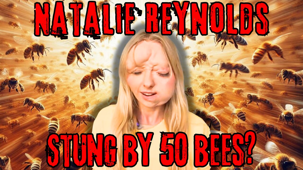 Natalie Reynolds Stung By 50 Bee's?