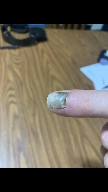 I smashed it in the Wood splitter.