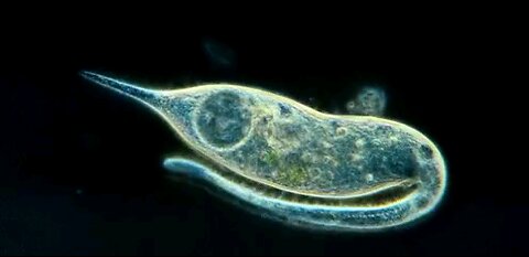 MICROBE BRAIN DE NIRO BLABS AWAY