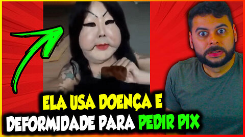 ELA USA DOENÇA E DEFORMIDADE PARA PEDIR PIX