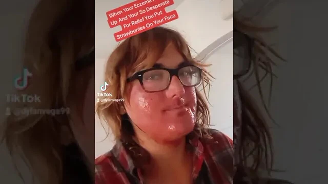 When Your Eczema Flares Up And Your So Desperate For Relief You Put Strawberries On Your Face