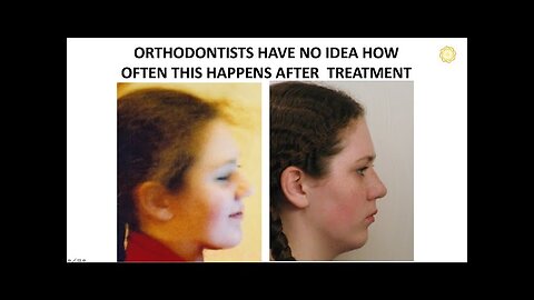 The lack of research in orthodontics