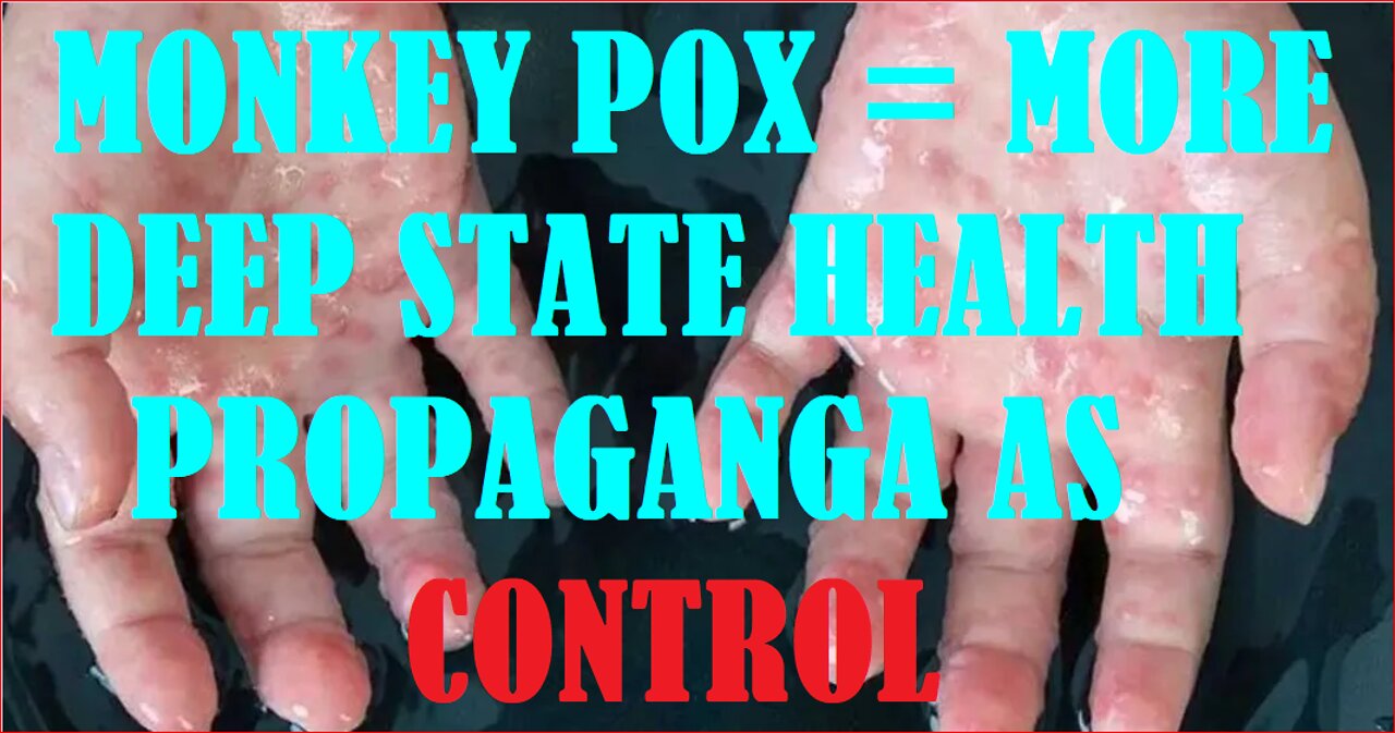 MONKEY POX = MORE DEEP STATE HEALTH PROPAGANDA AS CONTROL