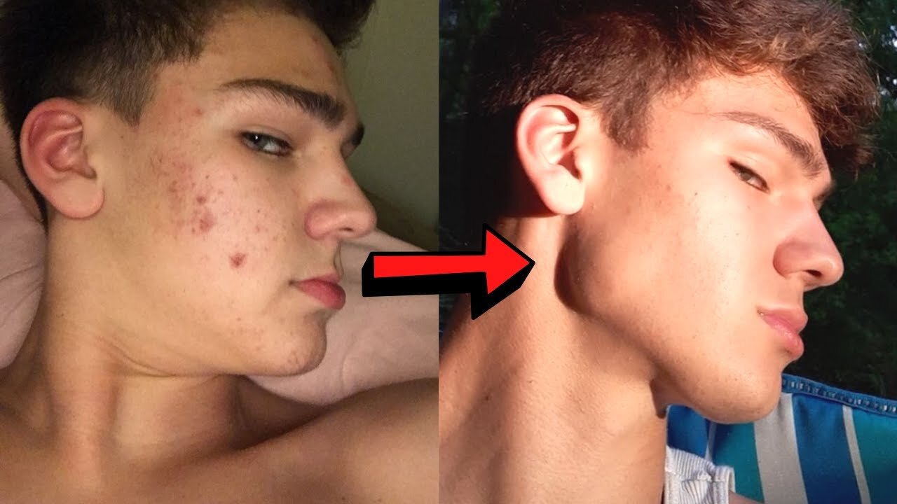 How to improve your facial attractiveness (my in depth guide)