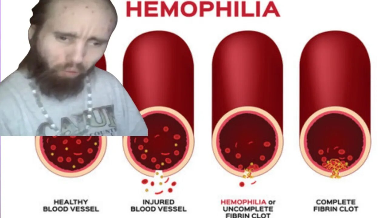 Cyraxx the Hemophilia...