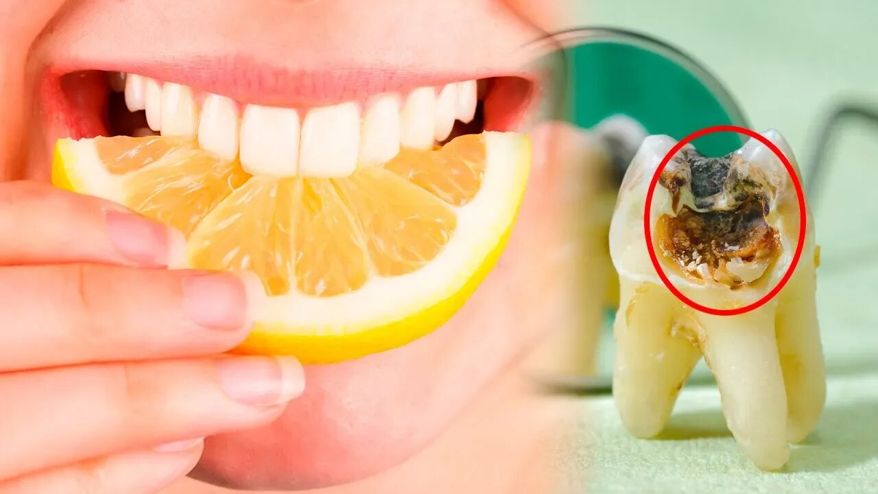 The 7 Worst Foods for Your Teeth