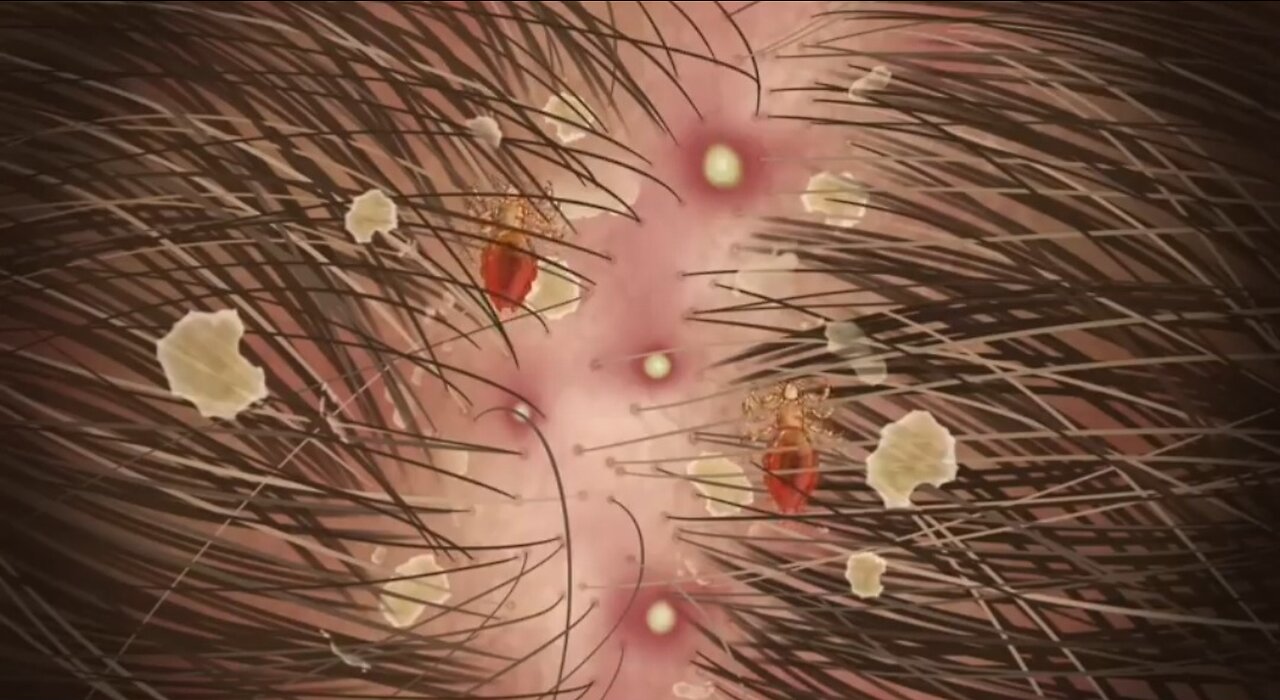 Animation of removing pimples and repairing hair