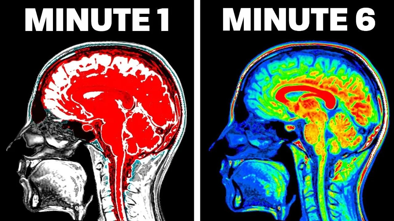 FASTEST Way to Reprogram Your Brain and ACTUALLY Get Rich