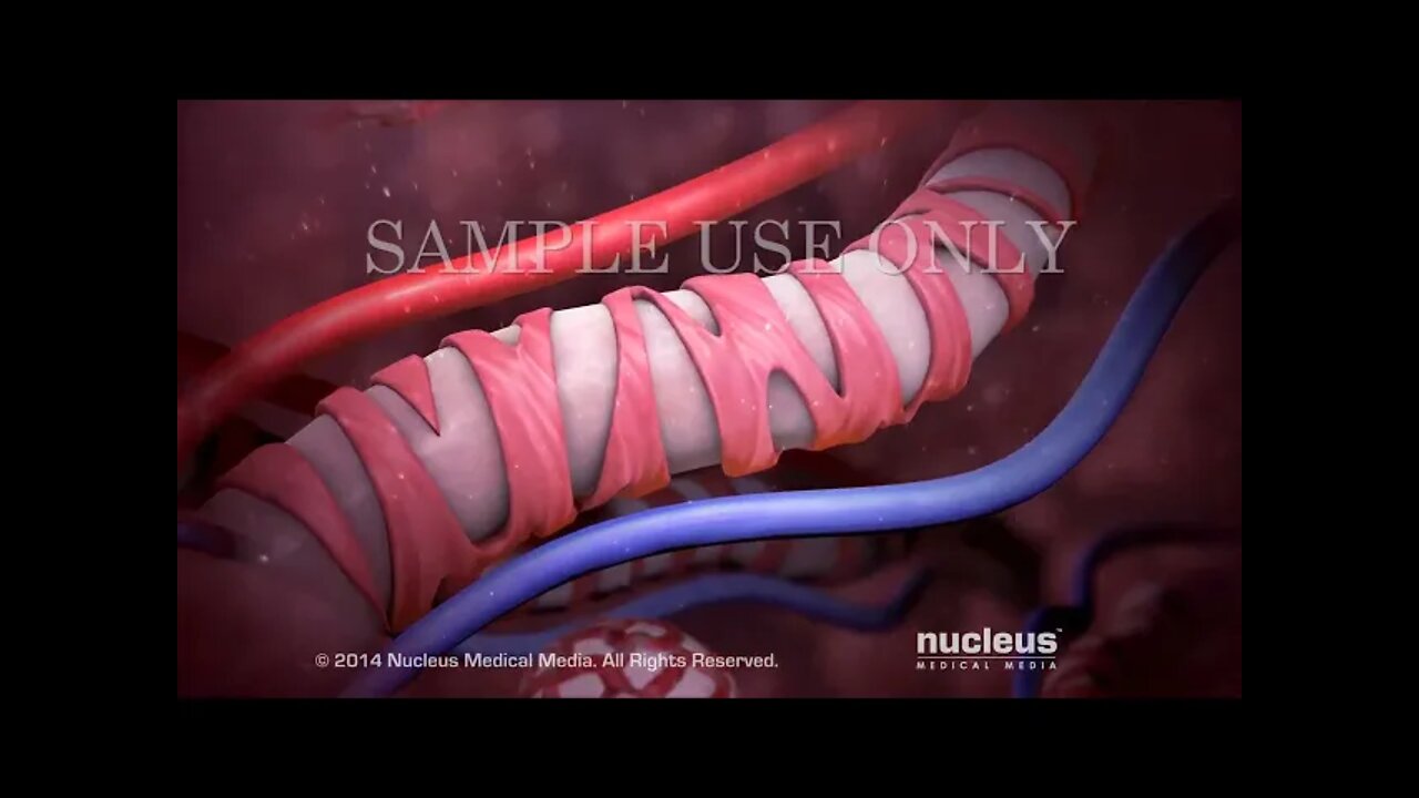 Espirometría