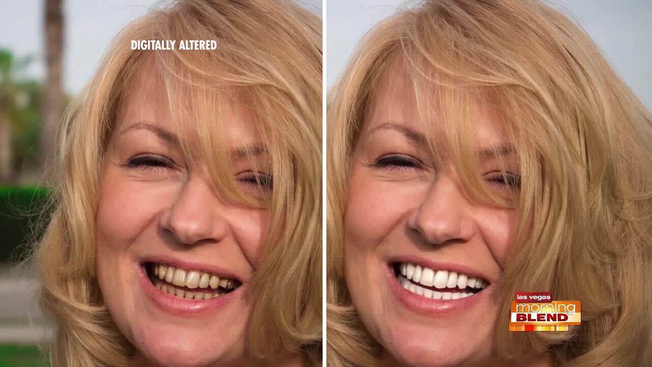 Whiter Teeth In Only 5 Minutes!