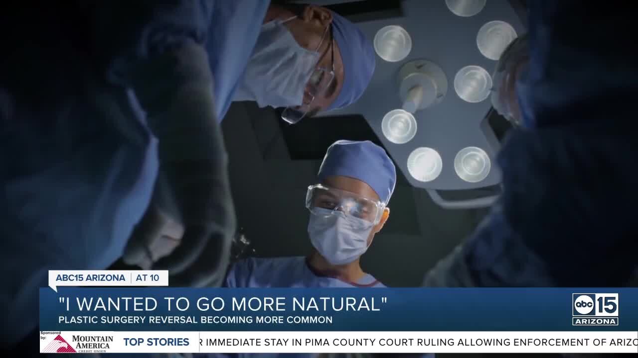 Plastic surgery reversal becoming more common