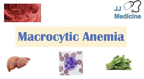 Macrocytic Anemia | Megaloblastic vs Non-Megaloblastic | Approach & Causes