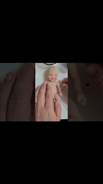 Eye Surgery For Baby #shorts