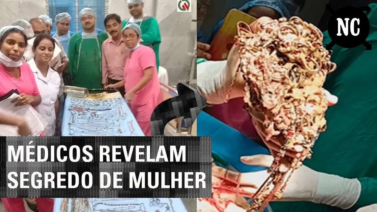 Ela escondia um segredo estranho da família. Quando os médicos revelaram o que havia de errado...