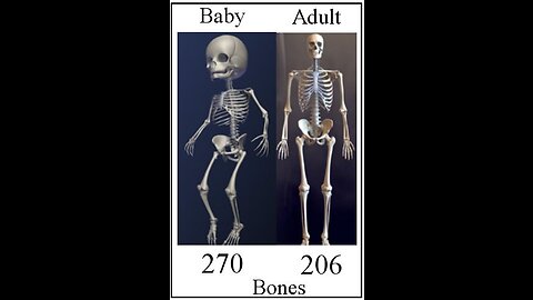 Babies have more bones than adults