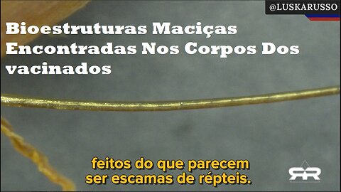 Bioestruturas Maciças Encontradas Nos Corpos Dos 💉