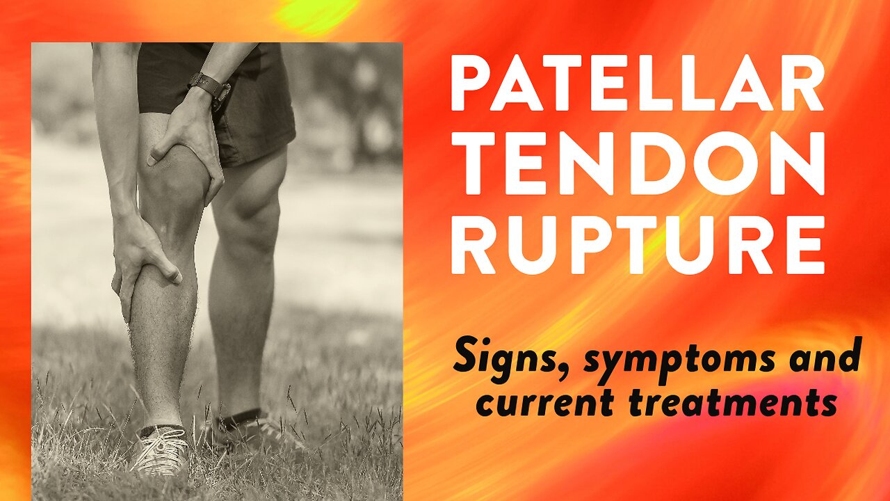 Patellar tendon rupture: Signs, symptoms and current treatments