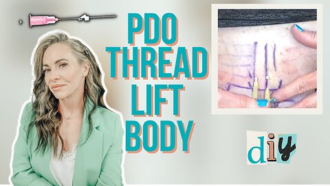 PDO Thread Lift Body: PDO Skin Tightening