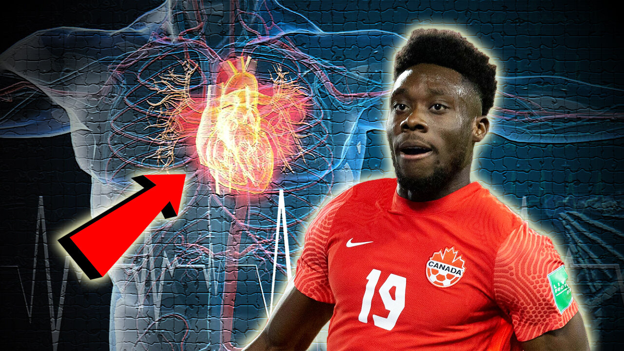 Triple Vaxxed Soccer Superstar Alphonso Davies Has Myocarditis, Officials Say It’s Due To Covid 👀