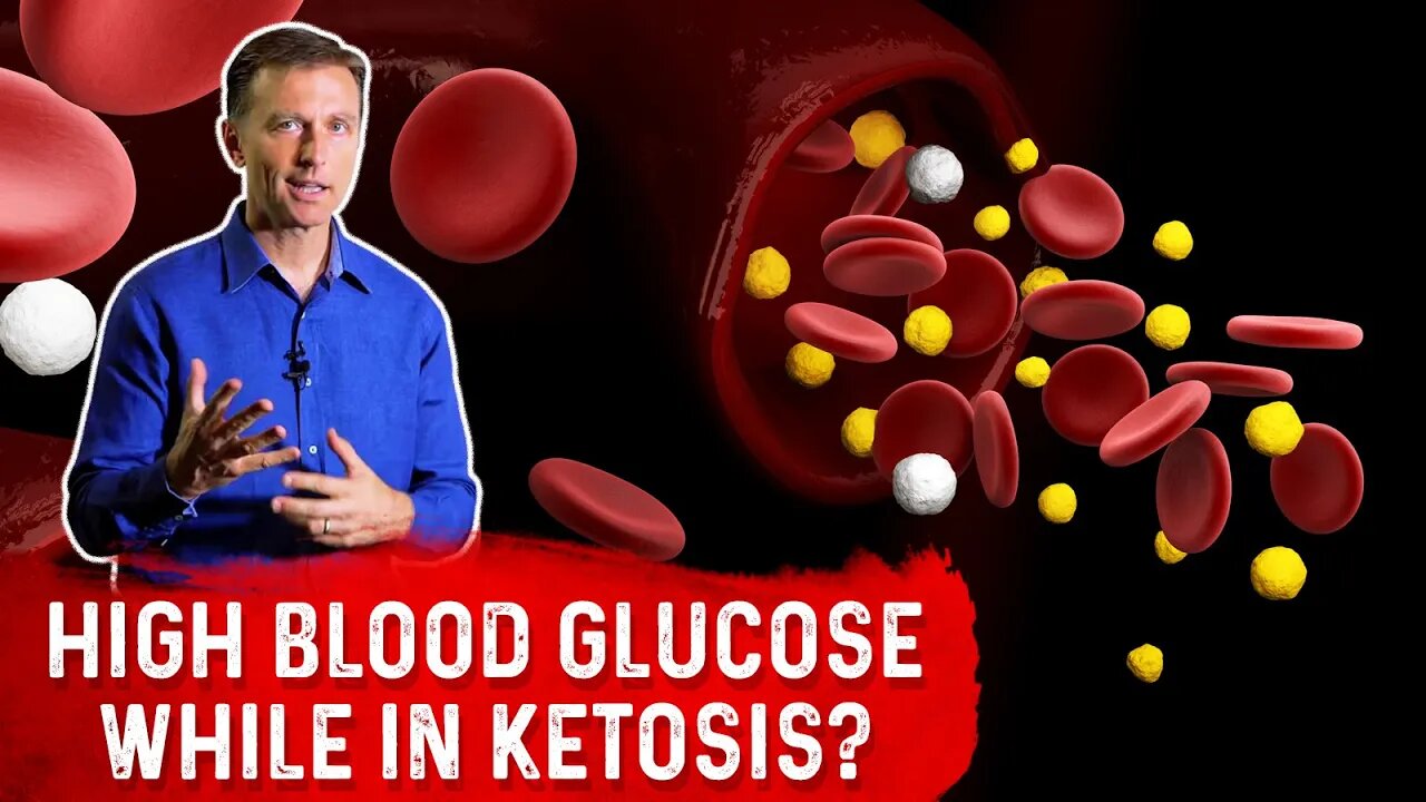 The Main Reason of High Blood Glucose While in Ketosis – Dr. Berg