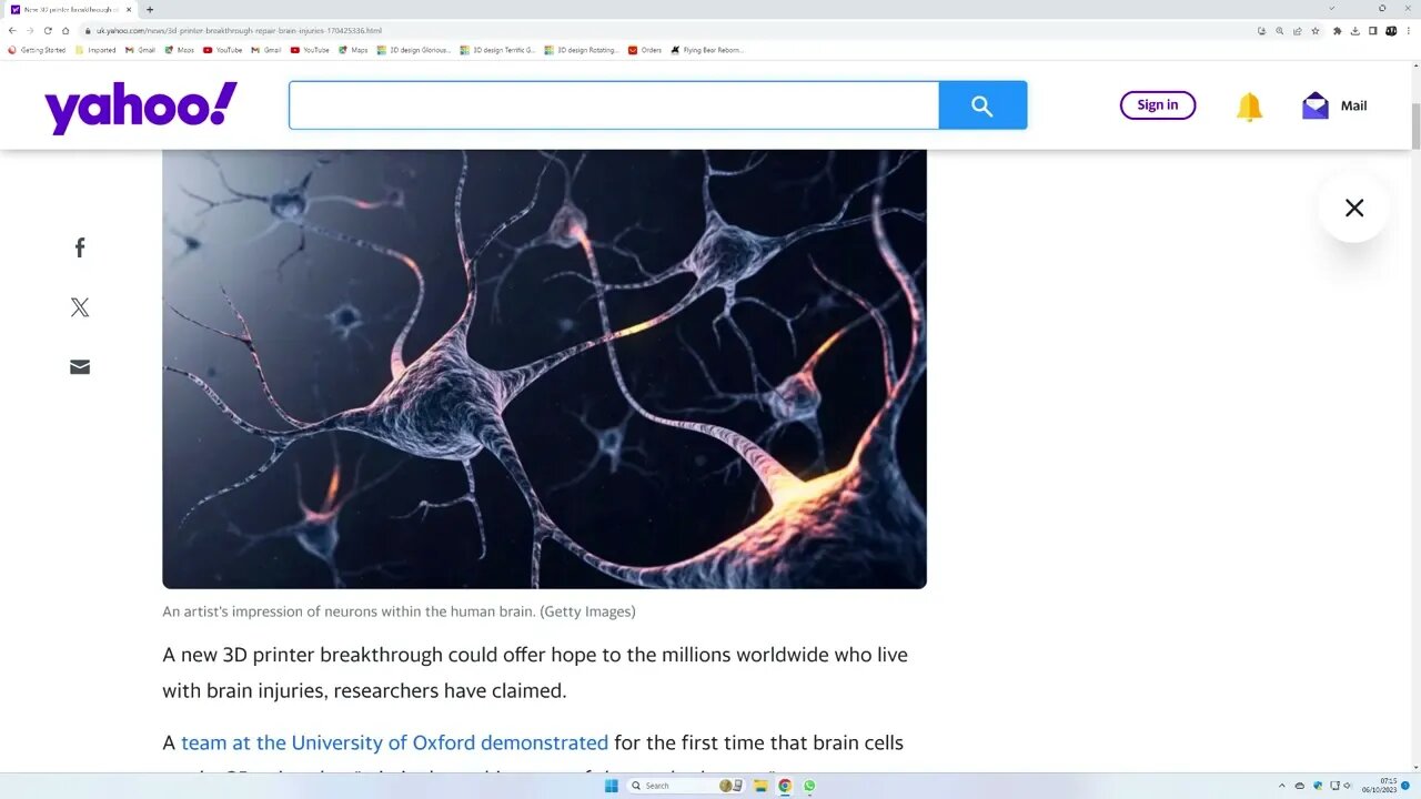 Repair a brain using a 3D printer