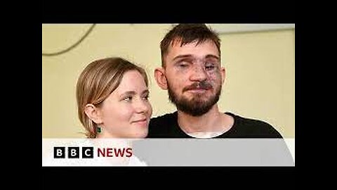 How Ukraine_s war wounded repair their lives - BBC News