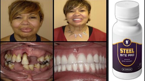 4.Get Rid of HOW TO TREAT GUM DISEASE, TOOTH DECAY OR BAD BREATH Once and For All