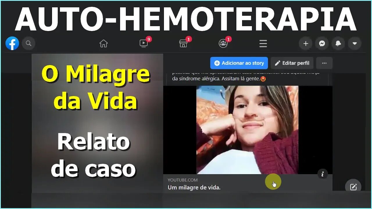 Auto-hemoterapia O Milagre da Vida. Relato de Caso Documentado