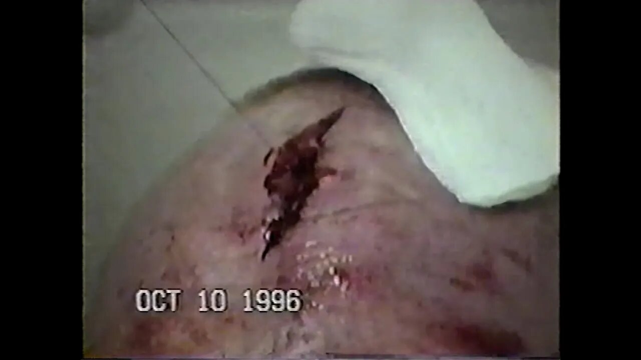 Wrestler SPLITS his entire forehead open! Bull Pain vs Rocco Rock-IWA MS Start of Something Big 1996