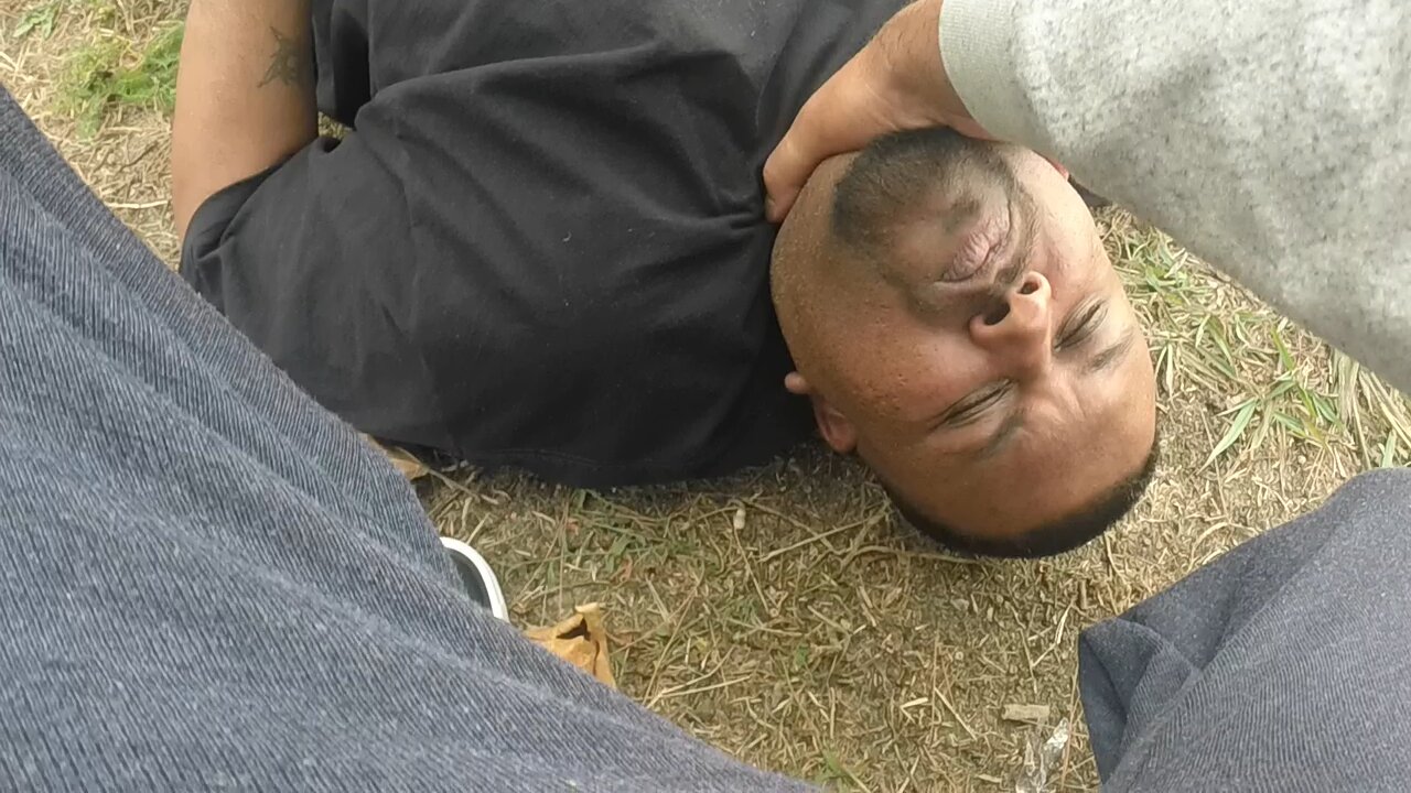 Man FINALLY Able to Move His Neck After 6 Years Due to Cervical Dystonia