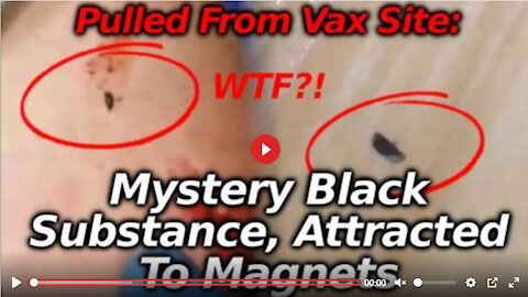 BLACK JUNK SURGICALLY REMOVED FROM INJECTION SITE WITH MAGNET & SCALPEL