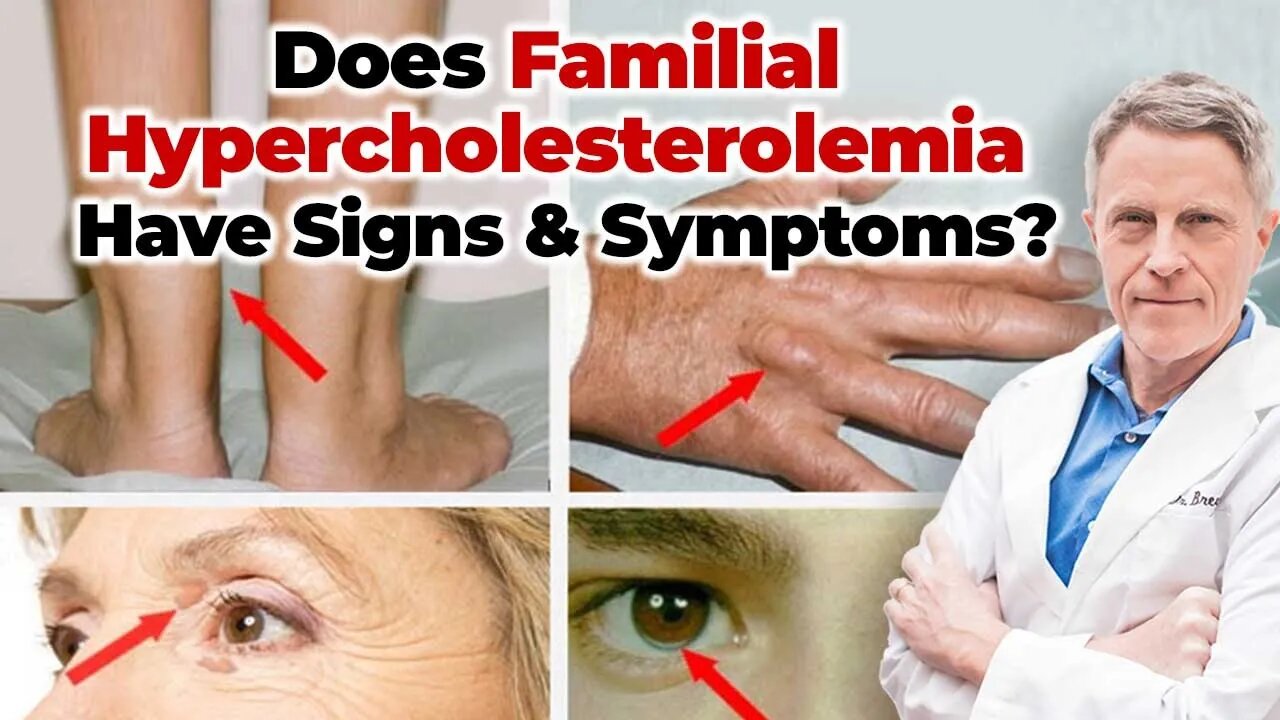 Does Familial Hypercholesterolemia Have Signs & Symptoms?