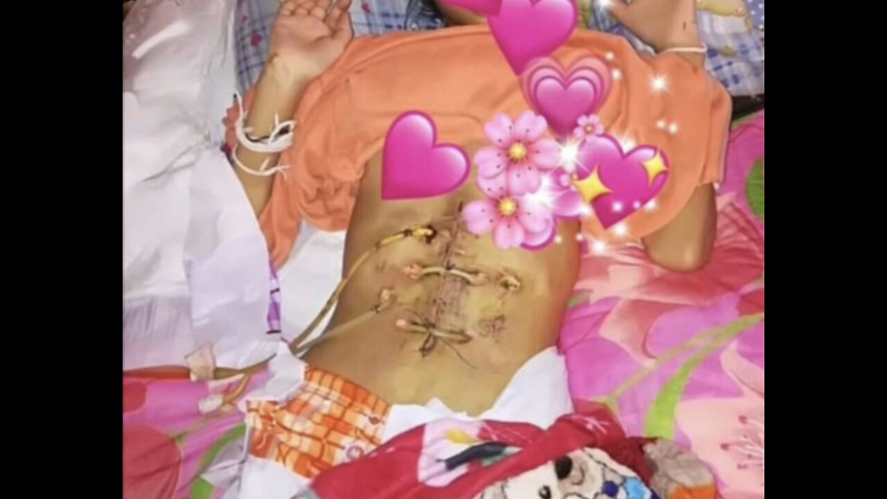 Sirirat: Young Teen Passes Away From Covid-19 Vaccine Side Effects Due To Internal Bleeding & Kidney Failure