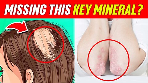10 Surprising Signs You’re Missing This Key Mineral! #HealthTips #MineralDeficiency #StayHealthy