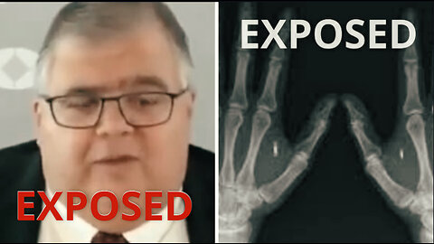 The Cryptobionic Implant : CBDC EXPOSED